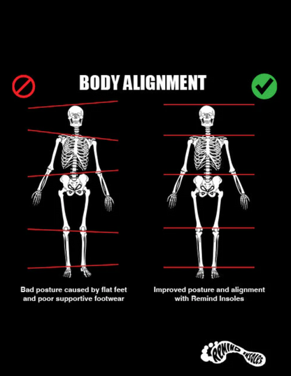 Remind Insoles Dead Foot